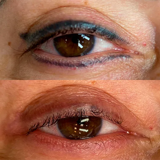 Antes e Depois
