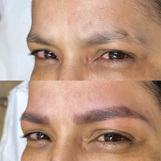 Antes e Depois